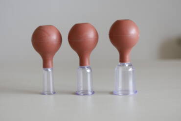 Ventosateràpia (cupping): beneficis, sensacions i per a qui és